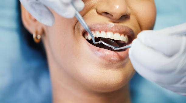 Best Knocked-Out Tooth Emergency  in Casa Blanca, AZ